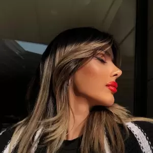 Burun Estetiği Sonrası