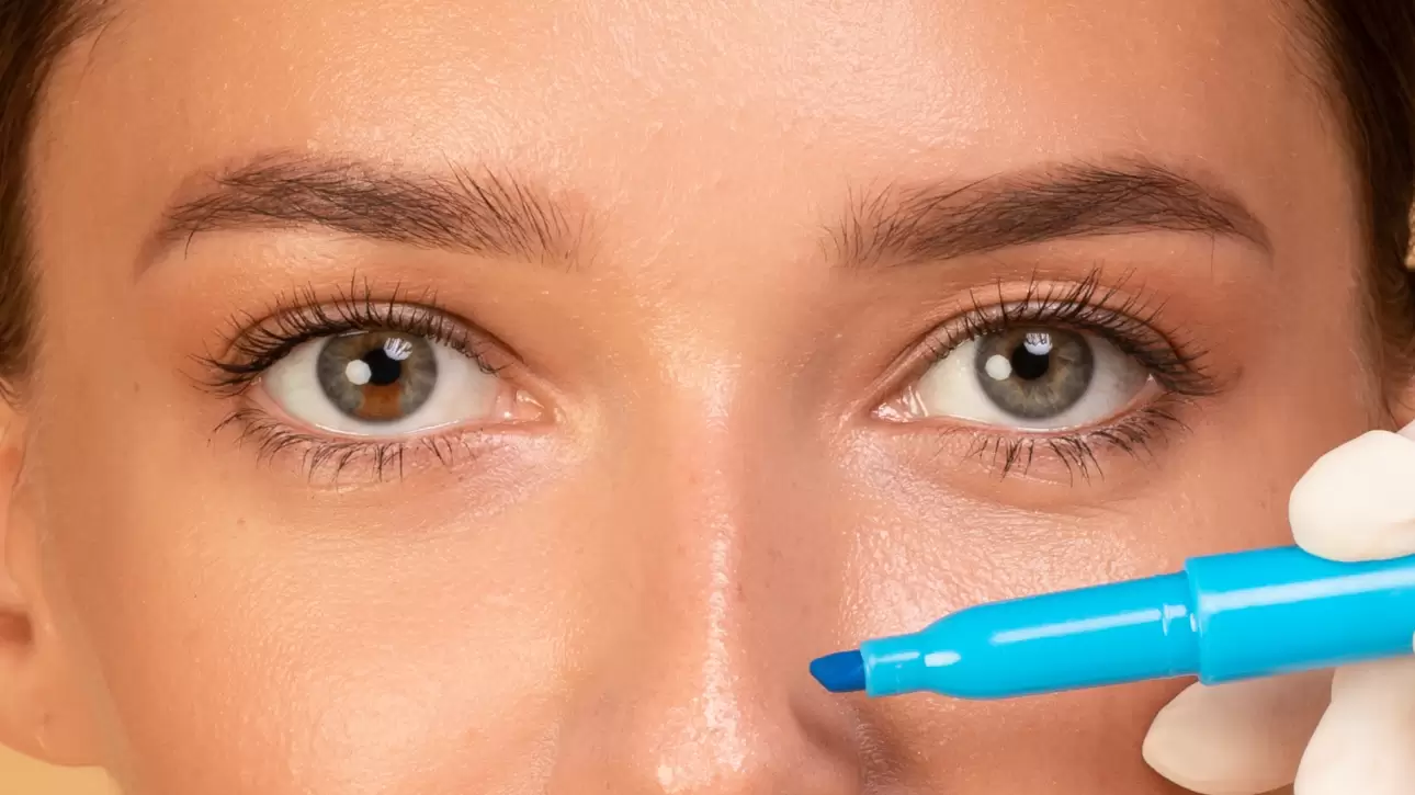 Burun Estetiği (Rinoplasti) Nedir? Kimlere Yapılabilir?